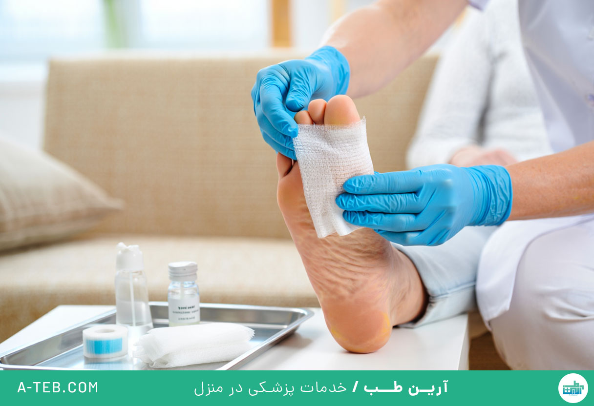 پانسمان زخم دیابتی در منزل