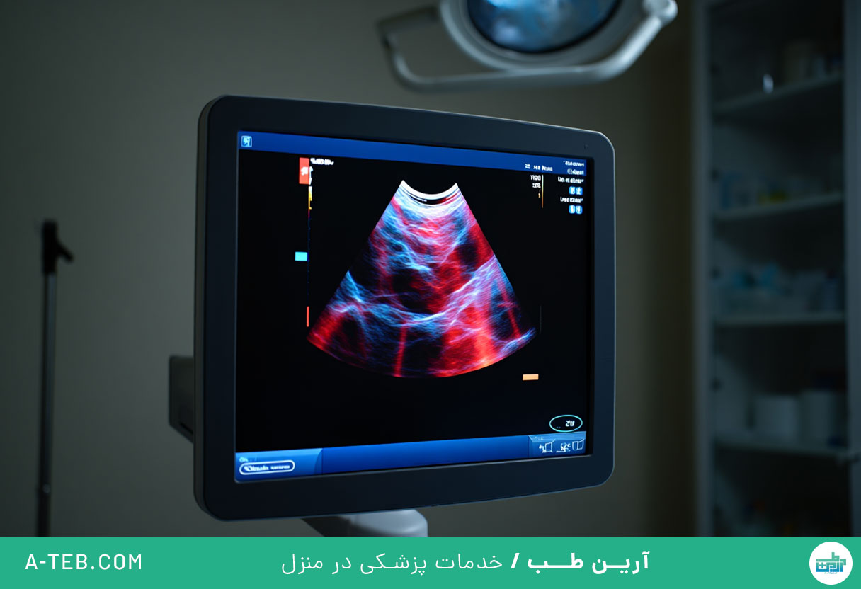 سونوگرافی کالر داپلر در منزل