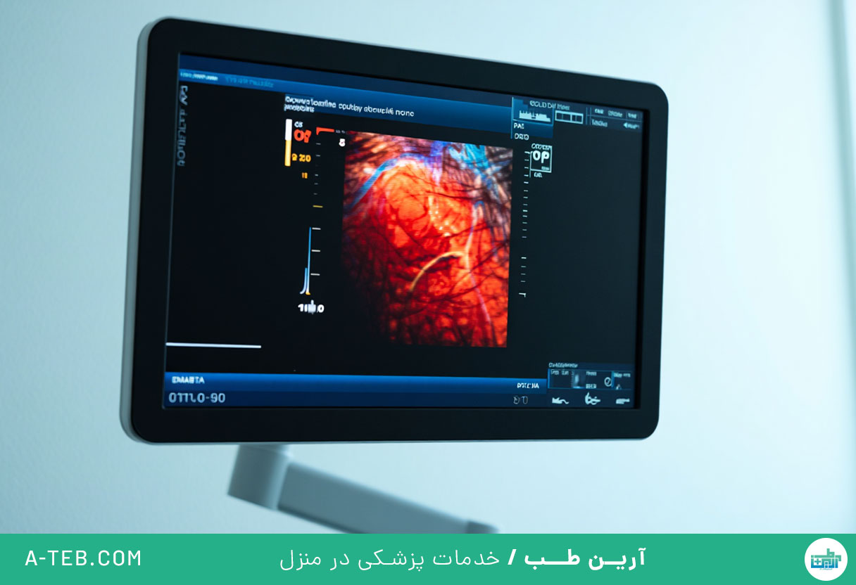 سونوگرافی کالر داپلر در منزل